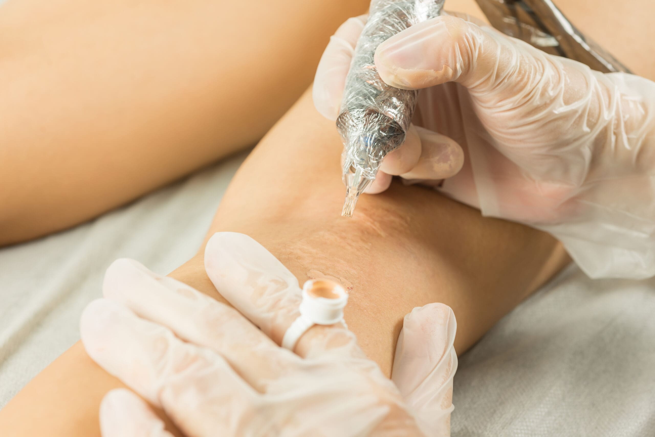 PMU artist performing stretch mark camouflage on stomach using tattoo machine, blending skin-tone pigment with precision, soft neutral tones, calm studio setting, Salt Lake City, Utah